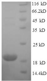 nikR Protein - (Tris-Glycine gel) Discontinuous SDS-PAGE (reduced) with 5% enrichment gel and 15% separation gel.