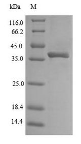 ompA Protein - (Tris-Glycine gel) Discontinuous SDS-PAGE (reduced) with 5% enrichment gel and 15% separation gel.