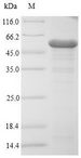 Outer Membrane Protein C Protein - (Tris-Glycine gel) Discontinuous SDS-PAGE (reduced) with 5% enrichment gel and 15% separation gel.