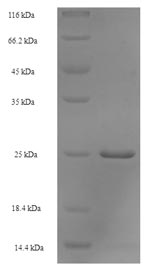 peptidyl-tRNA hydrolase Protein - (Tris-Glycine gel) Discontinuous SDS-PAGE (reduced) with 5% enrichment gel and 15% separation gel.