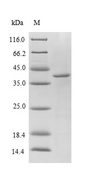 PPIA / Cyclophilin A Protein - (Tris-Glycine gel) Discontinuous SDS-PAGE (reduced) with 5% enrichment gel and 15% separation gel.