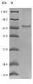 rpsB / Ribosomal Protein S2 Protein - (Tris-Glycine gel) Discontinuous SDS-PAGE (reduced) with 5% enrichment gel and 15% separation gel.