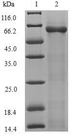 rtcB / RNA-Splicing Ligase Protein - (Tris-Glycine gel) Discontinuous SDS-PAGE (reduced) with 5% enrichment gel and 15% separation gel.