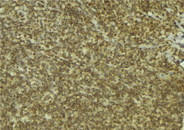 ESCO1 / ECO1 Antibody - 1:100 staining mouse pancreas tissue by IHC-P. The sample was formaldehyde fixed and a heat mediated antigen retrieval step in citrate buffer was performed. The sample was then blocked and incubated with the antibody for 1.5 hours at 22°C. An HRP conjugated goat anti-rabbit antibody was used as the secondary.