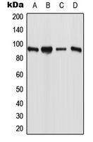 ESCO1 / ECO1 Antibody - Western blot analysis of ESCO1 expression in MCF7 (A); PANC1 (B); Raw264.7 (C); H9C2 (D) whole cell lysates.