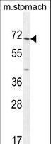 ESCO2 Antibody - ESCO2 Antibody western blot of mouse stomach tissue lysates (35 ug/lane). The ESCO2 antibody detected the ESCO2 protein (arrow).