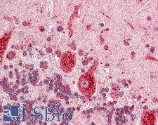 ESE3 / EHF Antibody - Human Brain, Cerebellum: Formalin-Fixed, Paraffin-Embedded (FFPE).  This image was taken for the unconjugated form of this product. Other forms have not been tested.