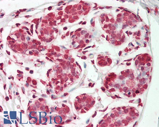 ESE3 / EHF Antibody - Human Breast: Formalin-Fixed, Paraffin-Embedded (FFPE).  This image was taken for the unconjugated form of this product. Other forms have not been tested.