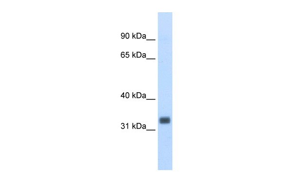ESE3 / EHF Antibody - Western blot analysis of mouse prostate lysate using Anti-ESE3 / EHF Antibody (aa71-120).  This image was taken for the unconjugated form of this product. Other forms have not been tested.