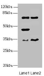 ESE3 / EHF Antibody - Western blot All Lanes: EHF antibody at 4.95ug/ml Lane 1 : Mouse brain tissue Lane 2 : Mouse lung tissue Secondary Goat polyclonal to Rabbit IgG at 1/10000 dilution Predicted band size: 35,33,38 kDa Observed band size: 35,45,63 kDa