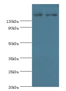 ESET / SETDB1 Antibody - Western blot. All lanes: SETDB1 antibody at 5 ug/ml. Lane 1: rat adrenal gland tissue. Lane 2: 293T whole cell lysate. Secondary antibody: Goat polyclonal to rabbit at 1:10000 dilution. Predicted band size: 143 kDa. Observed band size: 143 kDa.