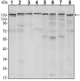ESET / SETDB1 Antibody - Western blot using SETDB1 mouse monoclonal antibody against MCF-7 (1),T47D (2), HEK293 (3), JURKAT (4), NIH/3T3 (5), F9 (6), RAW246.7 (7) and Cos7 (8) cell lysate.