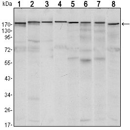 ESET / SETDB1 Antibody - SETDB1 Antibody in Western Blot (WB)
