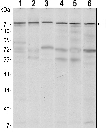 ESET / SETDB1 Antibody - Western blot using SETDB1 mouse monoclonal antibody against MCF-7 (1),T47D (2), HEK293 (3), JURKAT (4), NIH/3T3 (5) and F9 (6) cell lysate.