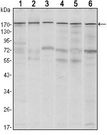 ESET / SETDB1 Antibody - SETDB1 Antibody in Western Blot (WB)
