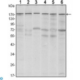ESET / SETDB1 Antibody - Western Blot (WB) analysis using ESET Monoclonal Antibody against MCF-7 (1),T47D (2), HEK293 (3), JURKAT (4), NIH/3T3 (5) and F9 (6) cell lysate.