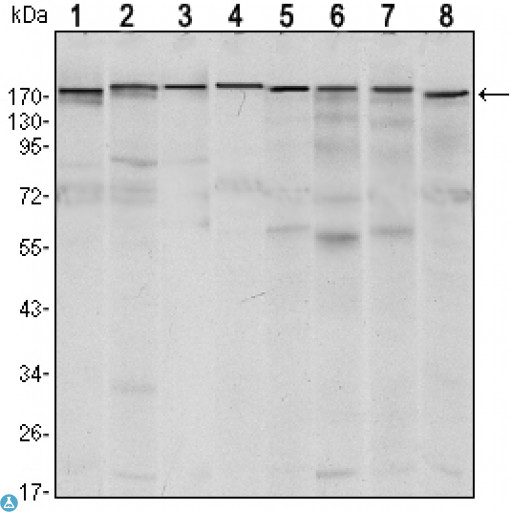 ESET / SETDB1 Antibody - Immunofluorescence (IF) analysis of LOVO cells using ESET Monoclonal Antibody (green). Red: Actin filaments have been labeled with Alexa Fluor-555 phalloidin.