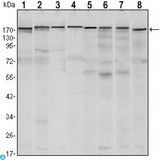 ESET / SETDB1 Antibody - Immunofluorescence (IF) analysis of LOVO cells using ESET Monoclonal Antibody (green). Red: Actin filaments have been labeled with Alexa Fluor-555 phalloidin.