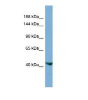 ESET / SETDB1 Antibody - Western blot of Human HT1080 Whole cell . SETDB1 antibody dilution 1.0 ug/ml.  This image was taken for the unconjugated form of this product. Other forms have not been tested.