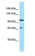ESF1 Antibody - ESF1 antibody Western Blot of MCF7.  This image was taken for the unconjugated form of this product. Other forms have not been tested.