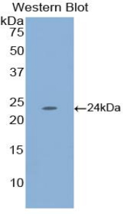 ESM1 / Endocan Antibody - Western blot of recombinant ESM1 / Endocan.  This image was taken for the unconjugated form of this product. Other forms have not been tested.