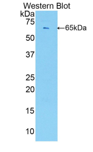 ESM1 / Endocan Antibody - Western blot of recombinant ESM1 / Endocan.