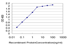 ESM1 / Endocan Antibody - Detection limit for recombinant GST tagged ESM1 is approximately 0.03 ng/ml as a capture antibody.