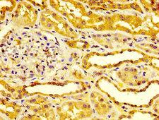 ESM1 / Endocan Antibody - IHC image of ESM1 Antibody diluted at 1:400 and staining in paraffin-embedded human kidney tissue performed on a Leica BondTM system. After dewaxing and hydration, antigen retrieval was mediated by high pressure in a citrate buffer (pH 6.0). Section was blocked with 10% normal goat serum 30min at RT. Then primary antibody (1% BSA) was incubated at 4°C overnight. The primary is detected by a biotinylated secondary antibody and visualized using an HRP conjugated SP system.