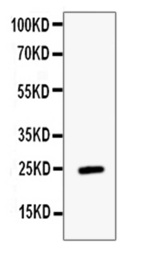 ESM1 / Endocan Antibody - Western blot analysis of ESM1 using anti-ESM1 antibody. Electrophoresis was performed on a 5-20% SDS-PAGE gel at 70V (Stacking gel) / 90V (Resolving gel) for 2-3 hours. Lane 1: recombinant human ESM1 protein 1ng. After Electrophoresis, proteins were transferred to a Nitrocellulose membrane at 150mA for 50-90 minutes. Blocked the membrane with 5% Non-fat Milk/ TBS for 1.5 hour at RT. The membrane was incubated with rabbit anti-ESM1 antigen affinity purified polyclonal antibody at 0.5 ?g/mL overnight at 4?C, then washed with TBS-0.1% Tween 3 times with 5 minutes each and probed with a goat anti-rabbit IgG-HRP secondary antibody at a dilution of 1:10000 for 1.5 hour at RT. The signal is developed using an Enhanced Chemiluminescent detection (ECL) kit with Tanon 5200 system. A specific band was detected for ESM1 at approximately 25KD. The expected band size for ESM1 is at 20KD.