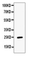 ESM1 / Endocan Antibody - Western blot analysis of ESM1 using anti-ESM1 antibody. Electrophoresis was performed on a 5-20% SDS-PAGE gel at 70V (Stacking gel) / 90V (Resolving gel) for 2-3 hours. Lane 1: recombinant human ESM1 protein 1ng. After Electrophoresis, proteins were transferred to a Nitrocellulose membrane at 150mA for 50-90 minutes. Blocked the membrane with 5% Non-fat Milk/ TBS for 1.5 hour at RT. The membrane was incubated with rabbit anti-ESM1 antigen affinity purified polyclonal antibody at 0.5 ?g/mL overnight at 4?C, then washed with TBS-0.1% Tween 3 times with 5 minutes each and probed with a goat anti-rabbit IgG-HRP secondary antibody at a dilution of 1:10000 for 1.5 hour at RT. The signal is developed using an Enhanced Chemiluminescent detection (ECL) kit with Tanon 5200 system. A specific band was detected for ESM1 at approximately 25KD. The expected band size for ESM1 is at 20KD.