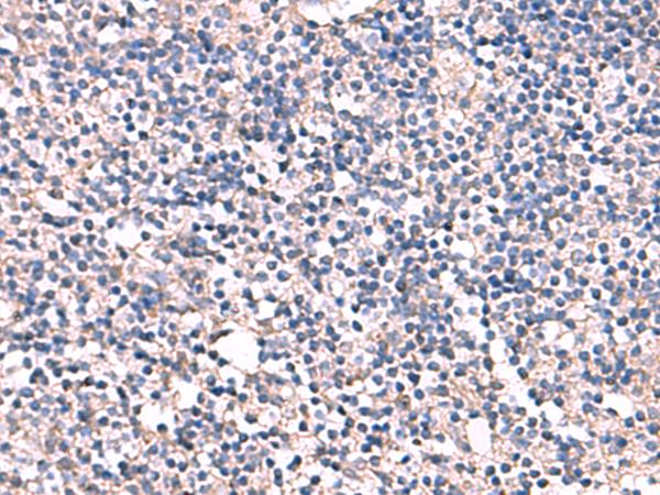 ESM1 / Endocan Antibody - Immunohistochemistry of paraffin-embedded Human tonsil tissue  using ESM1 Polyclonal Antibody at dilution of 1:55(×200)