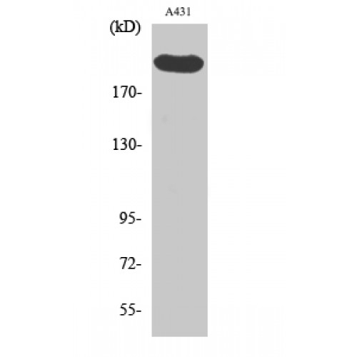 ESPL1 / Separase Antibody - Western blot of Separase antibody