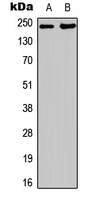 ESPL1 / Separase Antibody - Western blot analysis of Separase expression in A431 (A); HUVEC (B) whole cell lysates.