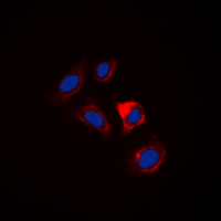 ESPL1 / Separase Antibody - Immunofluorescent analysis of Separase staining in HUVEC cells. Formalin-fixed cells were permeabilized with 0.1% Triton X-100 in TBS for 5-10 minutes and blocked with 3% BSA-PBS for 30 minutes at room temperature. Cells were probed with the primary antibody in 3% BSA-PBS and incubated overnight at 4 deg C in a humidified chamber. Cells were washed with PBST and incubated with a DyLight 594-conjugated secondary antibody (red) in PBS at room temperature in the dark. DAPI was used to stain the cell nuclei (blue).