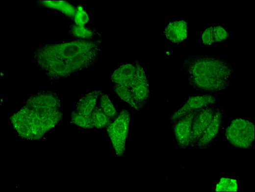 ESPL1 / Separase Antibody - Immunofluorescent analysis of HepG2 cells using ESPL1 Antibody at a dilution of 1:100 and Alexa Fluor 488-congugated AffiniPure Goat Anti-Rabbit IgG(H+L)