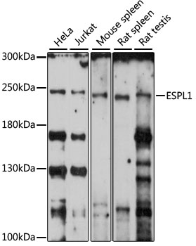 ESPL1 / Separase Antibody - Western blot analysis of extracts of various cell lines, using ESPL1 antibody at 1:1000 dilution. The secondary antibody used was an HRP Goat Anti-Rabbit IgG (H+L) at 1:10000 dilution. Lysates were loaded 25ug per lane and 3% nonfat dry milk in TBST was used for blocking. An ECL Kit was used for detection and the exposure time was 30s.