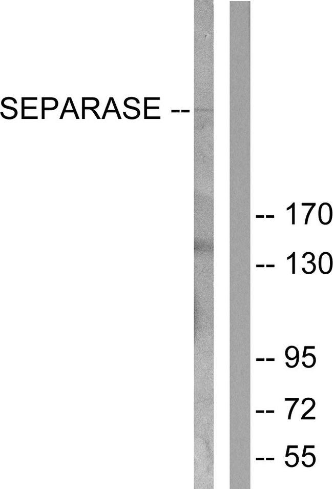 ESPL1 / Separase Antibody - Western blot analysis of extracts from 293 cells, treated with EGF (200ng/ml, 30mins), using SEPARASE (Ab-801) antibody.