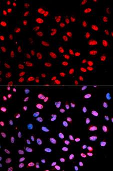 ESPL1 / Separase Antibody - Immunofluorescence analysis of U2OS cells.