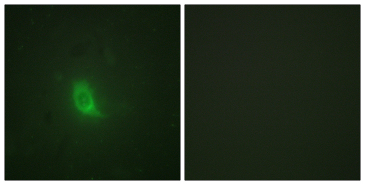 ESPL1 / Separase Antibody - Immunofluorescence analysis of HUVEC cells, using SEPARASE (Phospho-Ser801) Antibody. The picture on the right is blocked with the phospho peptide.