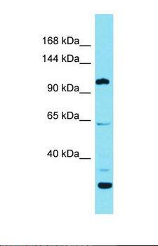 ESPNL Antibody - Western blot of Human NCI-H226. ESPNL antibody dilution 1.0 ug/ml.  This image was taken for the unconjugated form of this product. Other forms have not been tested.