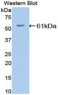 ESR2 / ER Beta Antibody - Western blot of recombinant ESR2 / ER Beta.  This image was taken for the unconjugated form of this product. Other forms have not been tested.