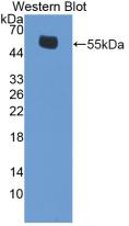 ESR2 / ER Beta Antibody - Western Blot;Sample: Recombinant ERb, Mouse.