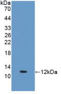 ESR2 / ER Beta Antibody - Western Blot; Sample: Recombinant ERb, Human.