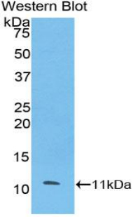 ESR2 / ER Beta Antibody - Western blot of recombinant ESR2 / ER Beta.  This image was taken for the unconjugated form of this product. Other forms have not been tested.