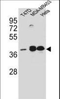 ESR2 / ER Beta Antibody - ESR2 Antibody western blot of T47D?MDA-MB453?HeLa cell line lysates (35 ug/lane). The ESR2 antibody detected the ESR2 protein (arrow).