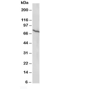 ESR2 / ER Beta Antibody - Western blot testing of Estrogen receptor beta antibody and MCF-7 cell lysate