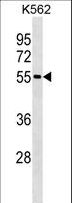 ESR2 / ER Beta Antibody - ESR2 Antibody western blot of K562 cell line lysates (35 ug/lane). The ESR2 antibody detected the ESR2 protein (arrow).