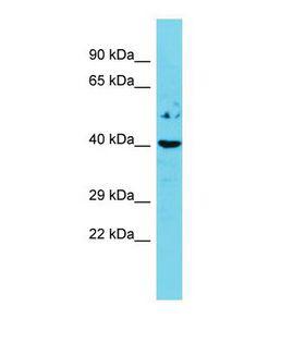 ESR2 / ER Beta Antibody - Western blot of Mouse Spleen. Esr2 antibody dilution 1.0 ug/ml.  This image was taken for the unconjugated form of this product. Other forms have not been tested.