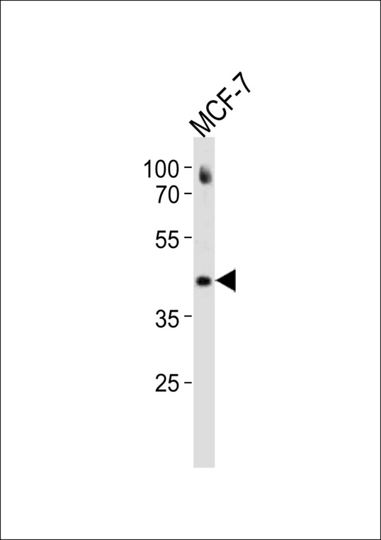ESR2 / ER Beta Antibody - ESR2 Antibody western blot of MCF-7 cell line lysates (35 ug/lane). The ESR2 antibody detected the ESR2 protein (arrow).