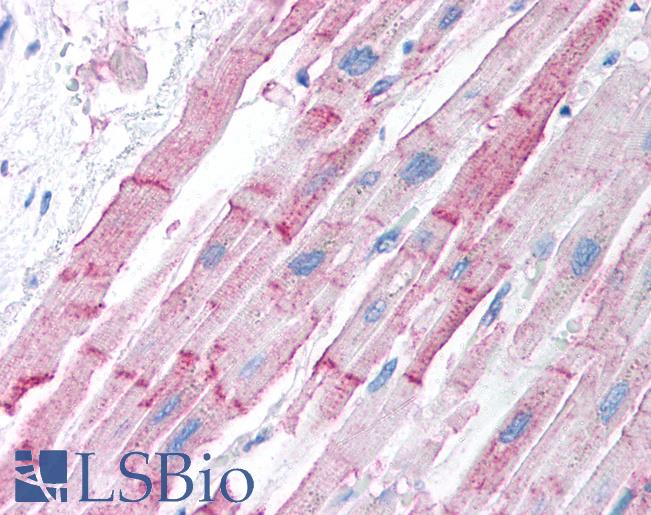 ESR2 / ER Beta Antibody - Anti-ER-Beta antibody IHC of human heart. Immunohistochemistry of formalin-fixed, paraffin-embedded tissue after heat-induced antigen retrieval. Antibody concentration 5 ug/ml.  This image was taken for the unconjugated form of this product. Other forms have not been tested.
